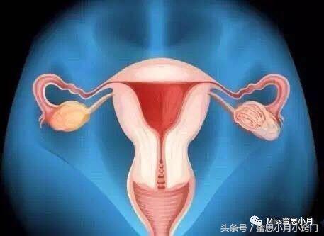 19岁女孩得了宫颈癌的征兆,19岁女孩会得宫颈癌吗