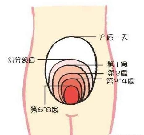 产后修复让子宫变得紧致,产后帮助子宫恢复的动作