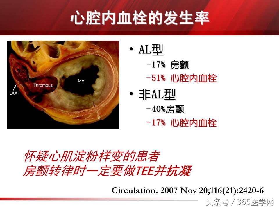 心力衰竭心房颤动,心衰时心肌酶的变化