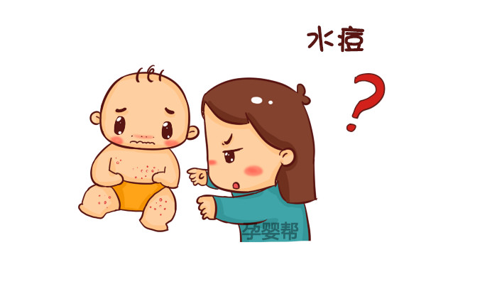 水痘症状预防视频,水痘的症状和治疗方法有哪些
