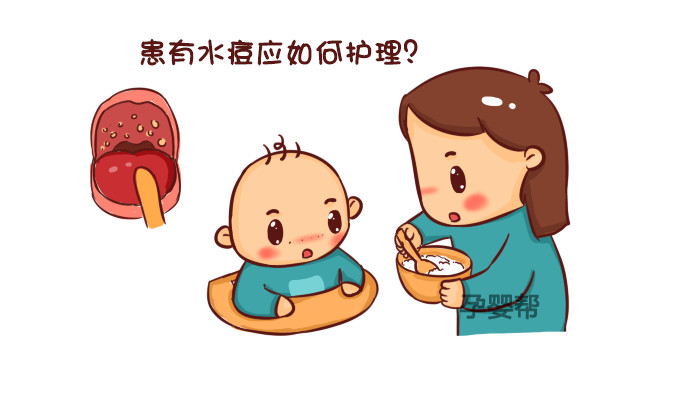 水痘症状预防视频,水痘的症状和治疗方法有哪些