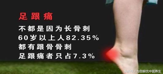 足跟痛如何用药,足跟痛治疗方法及用药