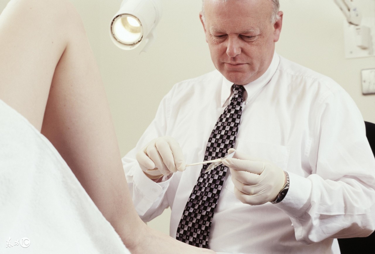 年轻人得了宫颈糜烂能自愈吗,24岁严重宫颈糜烂