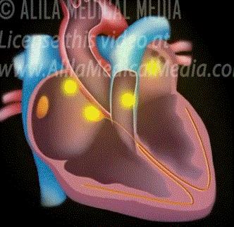 做房颤射频消融手术前的关注事项,房颤射频消融术后如何康复