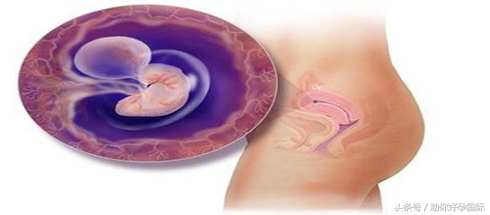 瘢痕子宫怀孕后要关注些什么,瘢痕子宫再怀孕需要关注什么