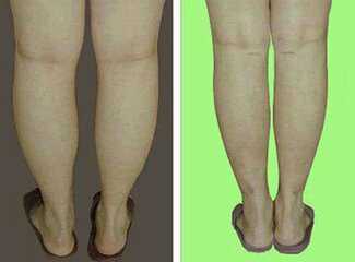 别不信！小腿就是这样被你一步步“撑粗”的