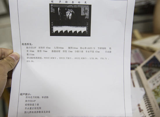 一张图看懂孕期b超单,怀孕的妈妈们看过来