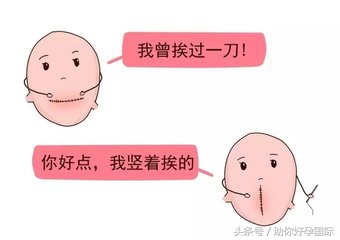 瘢痕子宫怀孕后要关注些什么,瘢痕子宫再怀孕需要关注什么