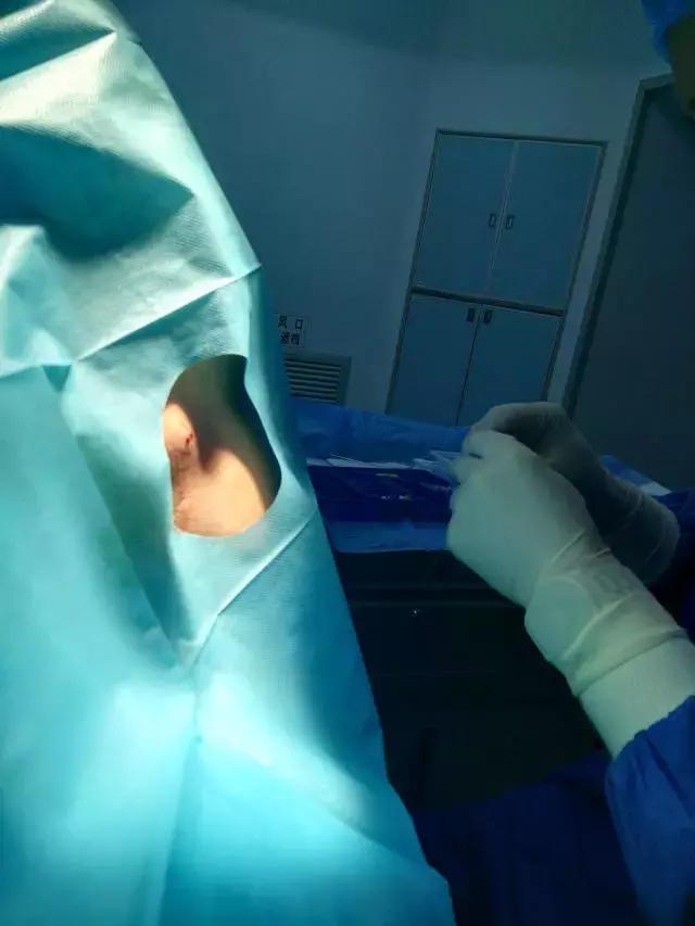 麻醉不是“打一针”那么简单！