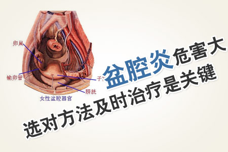 盆腔炎的自我疗法用盐可以吗,盆腔炎症状自我检查