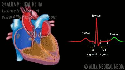 做房颤射频消融手术前的关注事项,房颤射频消融术后如何康复
