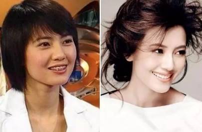 网上买透明牙套矫正牙齿靠谱吗,小孩矫正牙齿用哪种牙套比较好