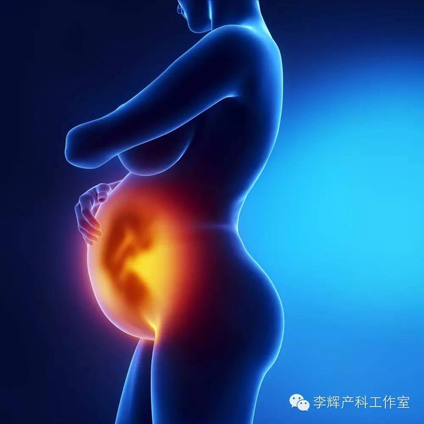 产科医生如何判断羊水情况,产科医生谈羊水栓塞