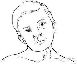 瘦脸针只打一针管用吗,瘦脸针只瘦咬肌吗