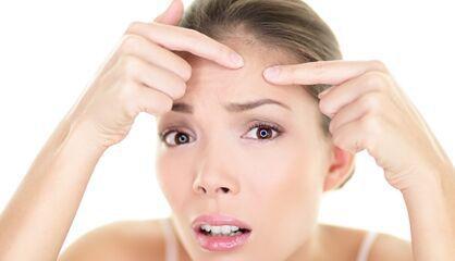 脸上长脓痘痘怎么处理,人中长脓痘怎么办