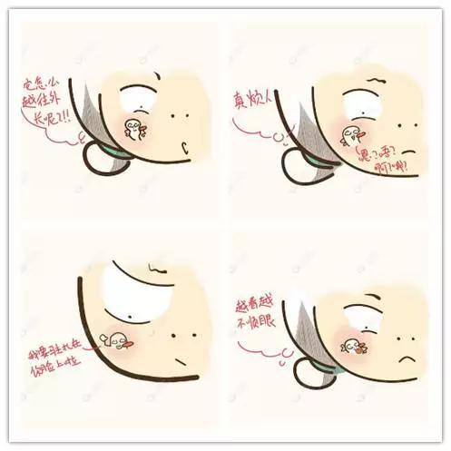 如何挤痘痘才是正确的方法,手把手教你挤痘痘