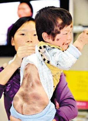 健康知识如何去脸部黑斑,清除脸褐斑吃什么