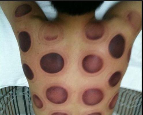 平时总有粘痰黄痰怎么排出,粘痰痰多的食疗法