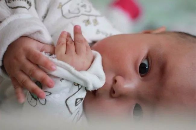 宝宝湿疹反反复复预防护理有技巧,宝宝湿疹如何预防护理