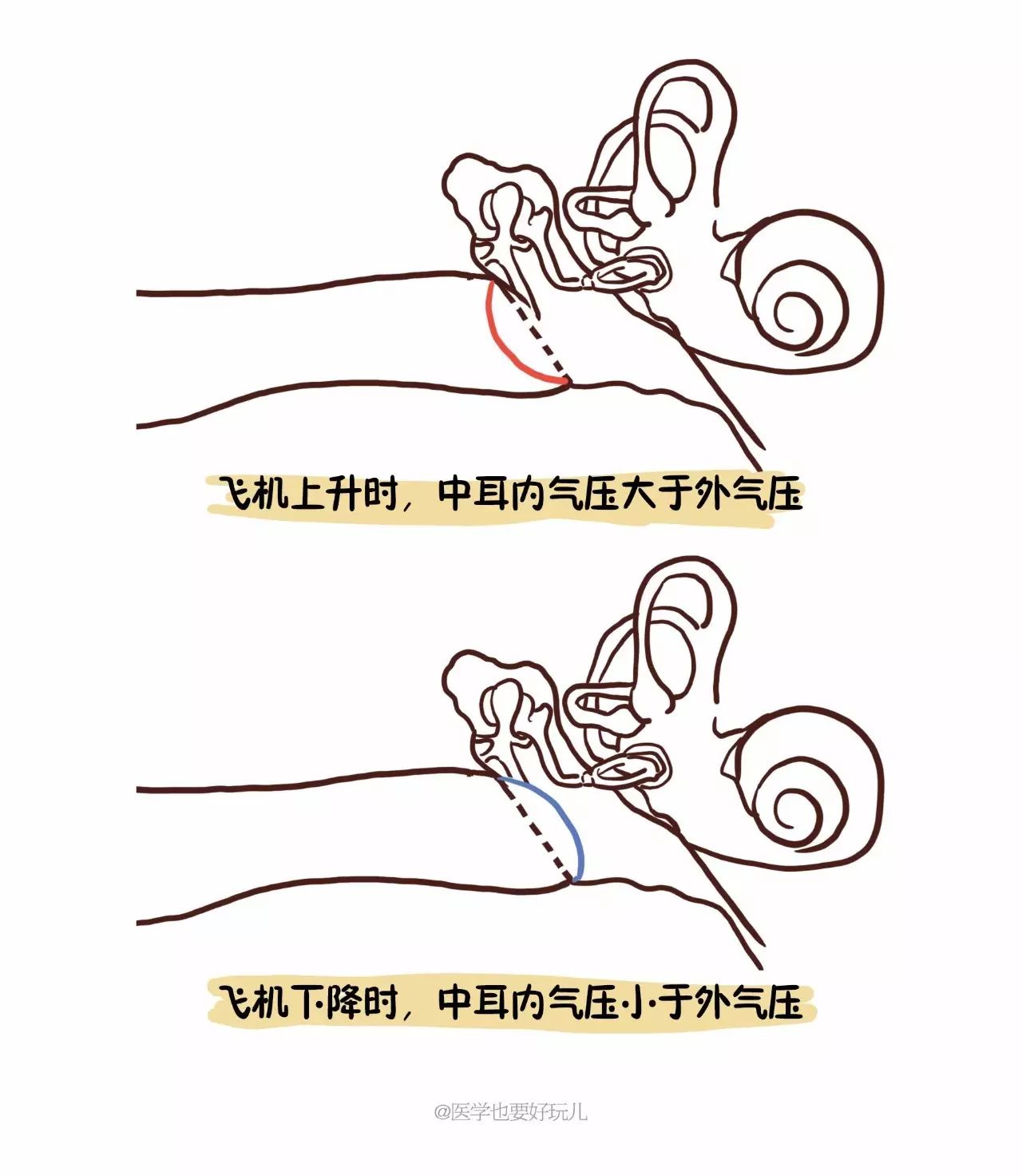 医学漫画科普｜国庆中秋出行坐飞机时，耳朵为什么会难受？