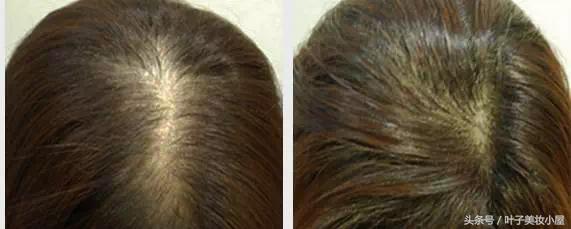 有哪些超好用的泰国货,泰国代购必买品