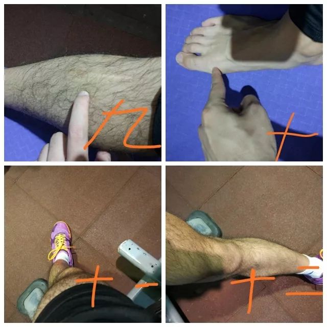 髌腱支持带在哪个位置,髌腱炎和髌腱末端病的区别