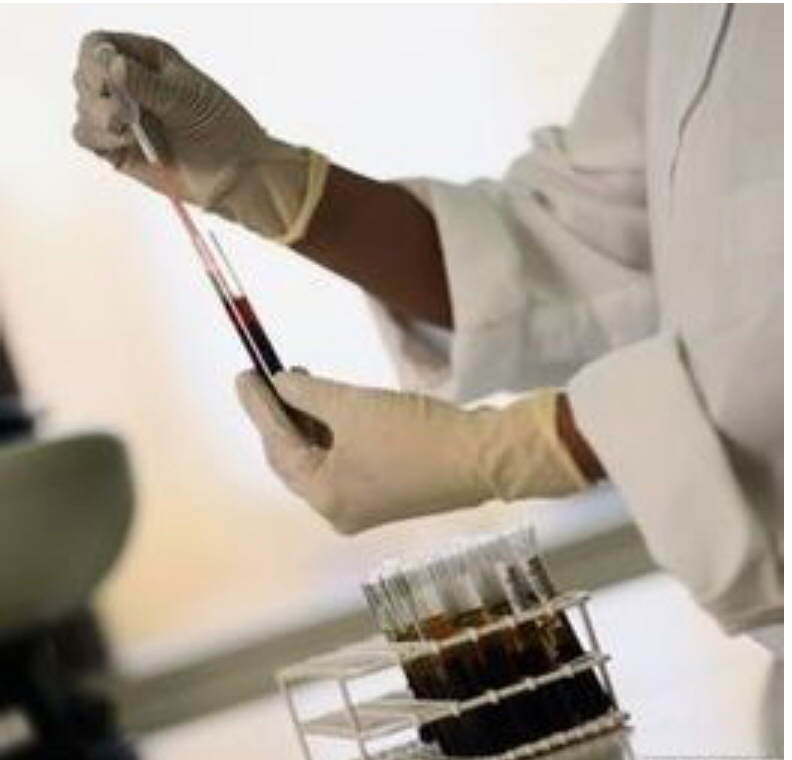 孕期耻骨疼要关注什么事项,准妈妈说说自己刚怀孕的症状