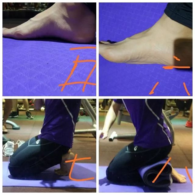 髌腱支持带在哪个位置,髌腱炎和髌腱末端病的区别