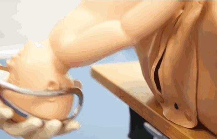 胎儿臀位出生视频,孕晚期胎儿臀位纠正视频