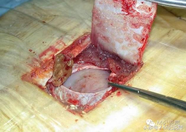 苏卡达陆龟乌龟卡脖子,苏卡达陆龟下颚裂开