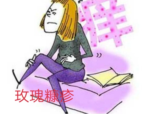 玫瑰糠疹有什么需要关注的,玫瑰糠疹自愈后还需要忌口吗