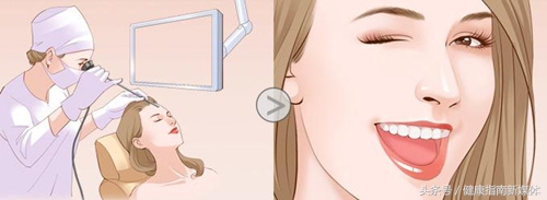 瘦脸针科普,水光针跟瘦脸针有什么区别