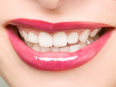 洗牙不能吃什么,洗牙后什么食物不能吃