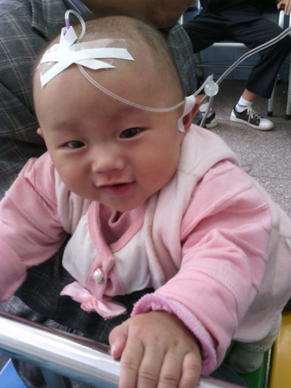 宝宝反复发烧还咳嗽用输液么,婴儿感冒咳嗽反复发烧要输液吗