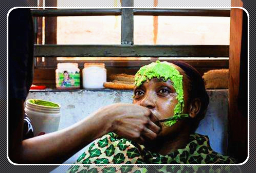 这种方法比整容还猛，非洲黑人女孩流行把全身肌肤漂白！