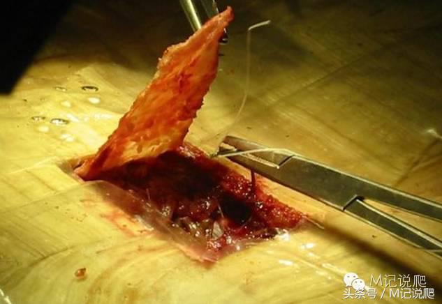 苏卡达陆龟乌龟卡脖子,苏卡达陆龟下颚裂开