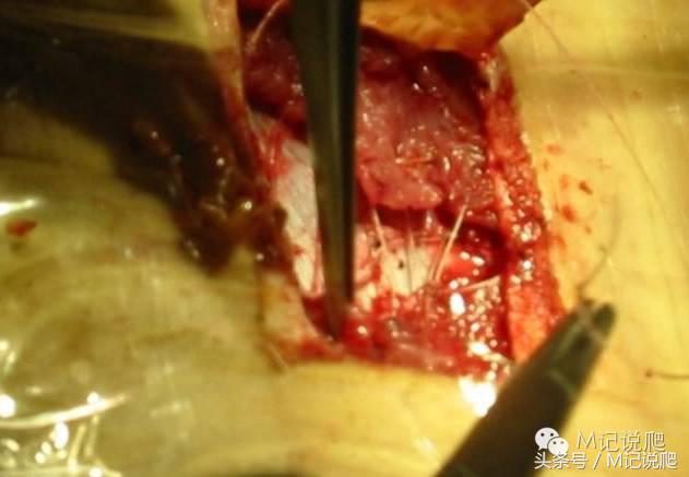 苏卡达陆龟乌龟卡脖子,苏卡达陆龟下颚裂开