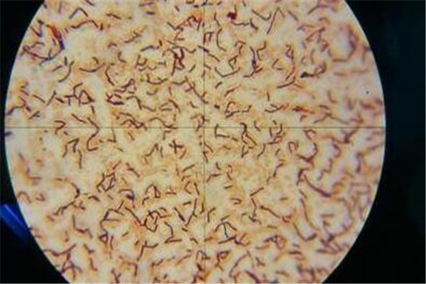 11个月的宝宝吃了半个苹果,11个月的宝宝吃了一个大苹果