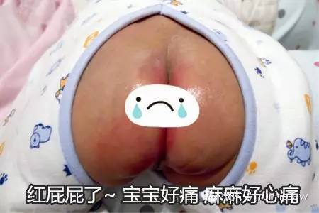 怎么快速有效的治宝宝红屁屁,宝宝突然红屁屁很严重手脚起红疹