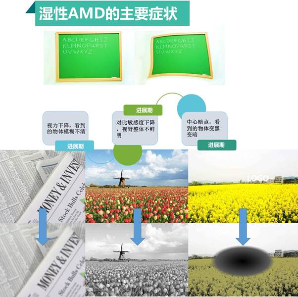 得了黄斑病变还能玩手机,得了黄斑病症状