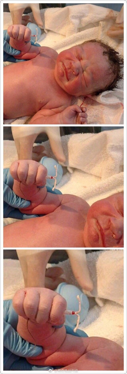 女性上环的好处及坏处,女性结扎和上环的好处及坏处