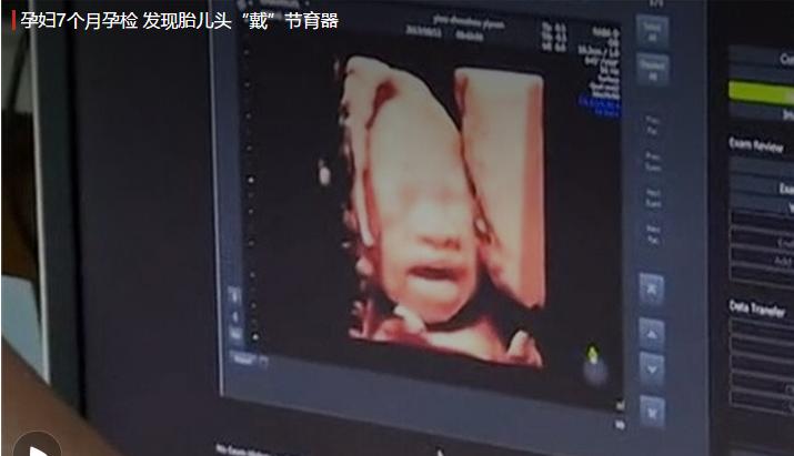 女性上环的好处及坏处,女性结扎和上环的好处及坏处