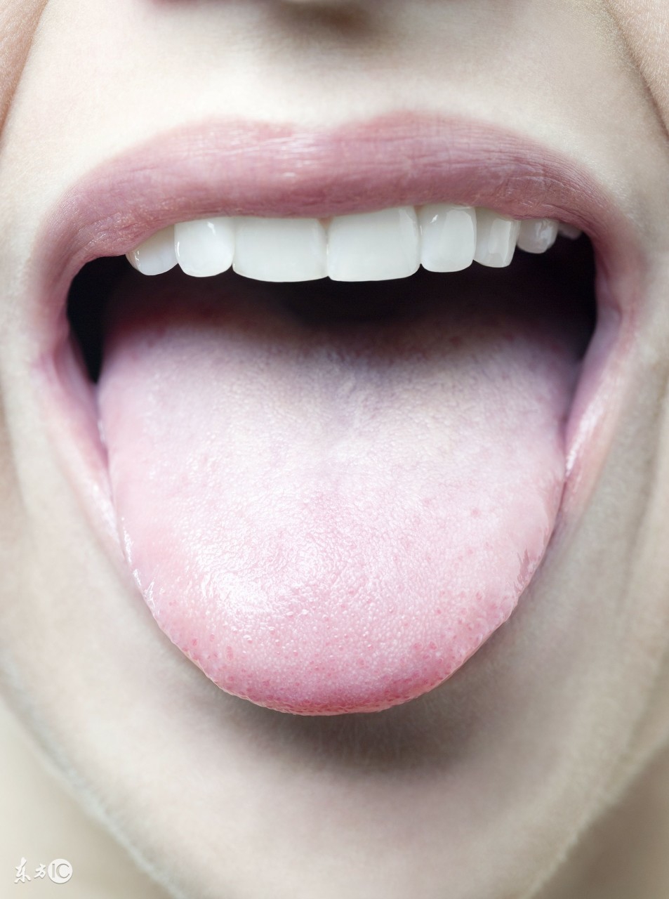 舌苔是厚厚的白苔用“姜”治口臭；舌苔发黄喝“萝卜汁”治口臭