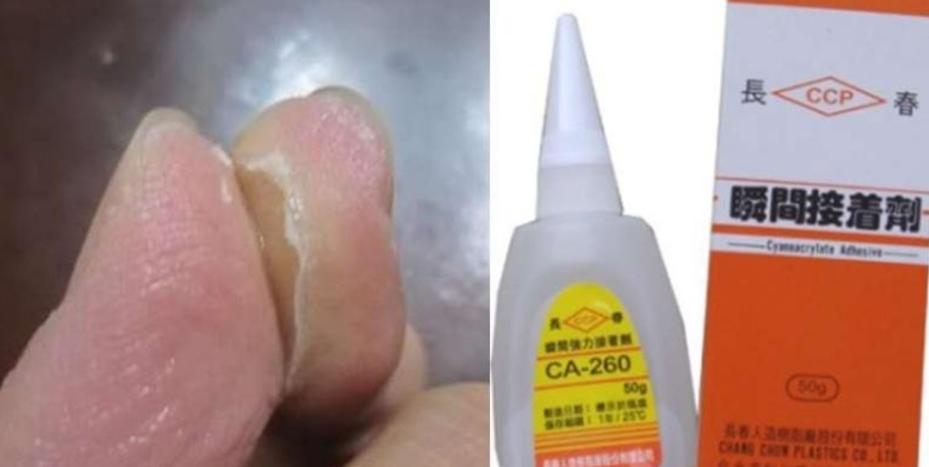 不谨慎被快干胶黏住手指怎么办？有了这些方法就不用着急了