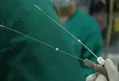 穿刺活检会导致癌细胞扩散,穿刺活检会导致癌细胞转移吗