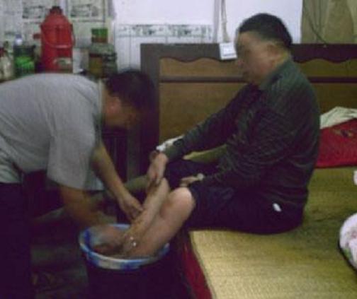 小腿浅静脉栓塞的症状及治疗方法,小腿深静脉栓塞的最佳治疗方法