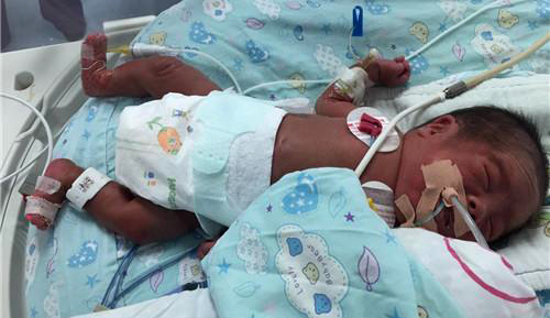 护士一时大意孕妇吃错药,护士疏忽婴儿死亡