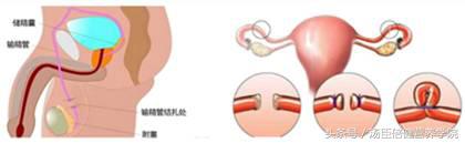 避孕用什么措施更好对身体没伤害,避孕可以用其他方法吗