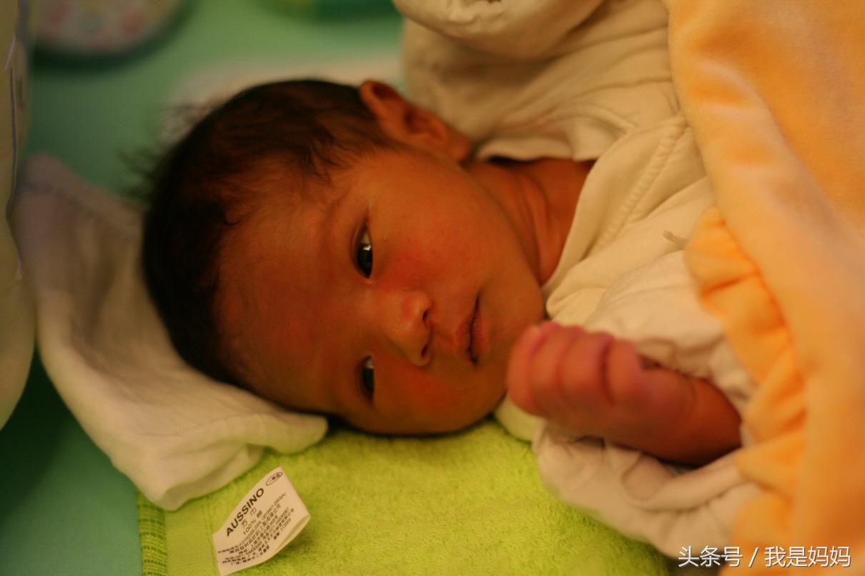 宝妈们宝宝有黄疸吃什么,宝妈们新生儿黄疸需要治疗吗