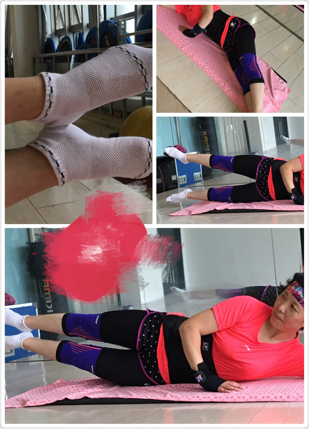 o型腿怎么矫正,O形腿的矫正方法